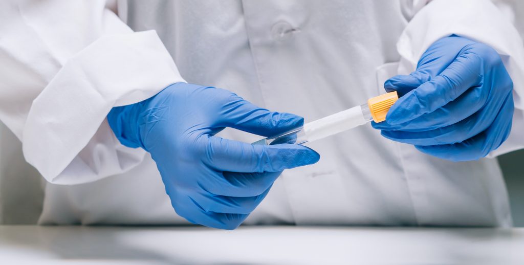female-medical-scientific-researcher-hands-holds-test-tube